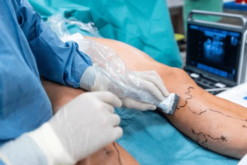 جراحة الأوعية الدموية