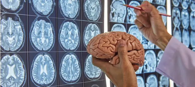عيادة المخ والأعصاب