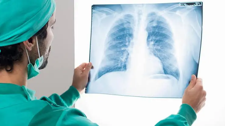 عيادة أمراض الصدر